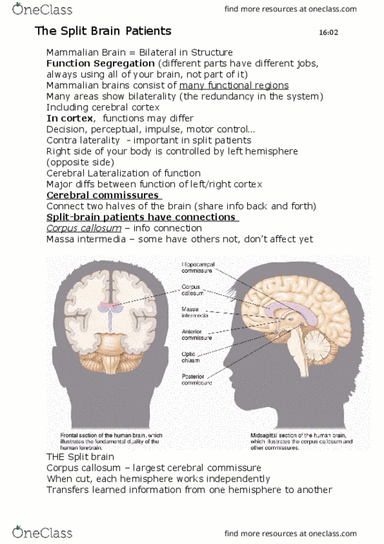 PSYC1110 Lecture Notes - Lecture 2: Interthalamic Adhesion, Optic Chiasm, Commissurotomy thumbnail