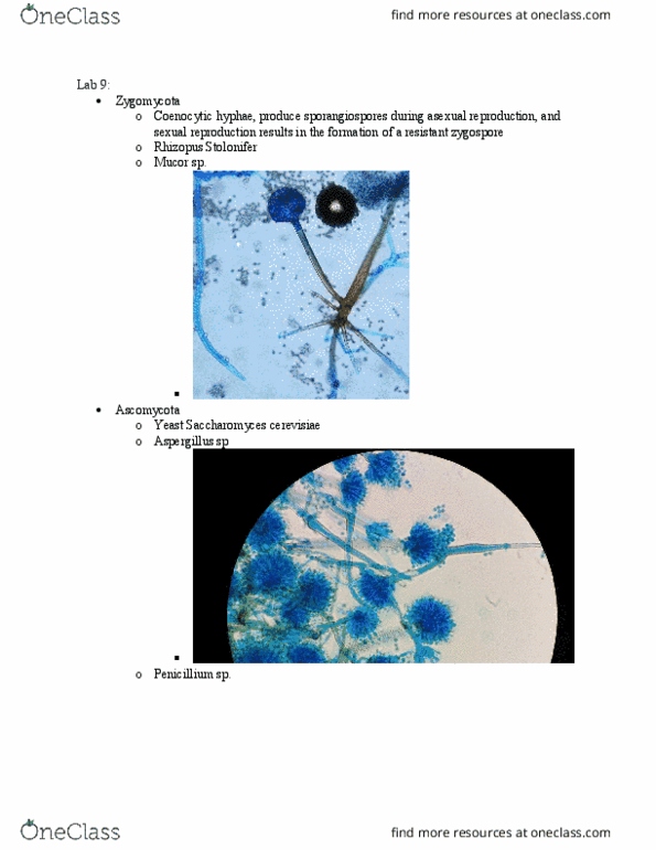 BIOLOGY 242 Lecture Notes - Lecture 7: Black Bread Mold, Saccharomyces Cerevisiae, Fungi Imperfecti thumbnail