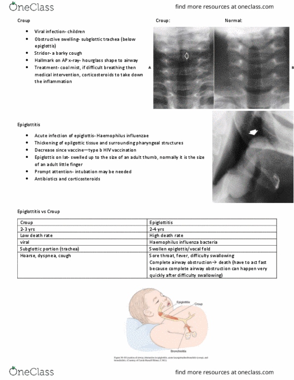 MEDRADSC 2I03 Lecture Notes - Lecture 9: Croup, Viral Disease, Stridor thumbnail