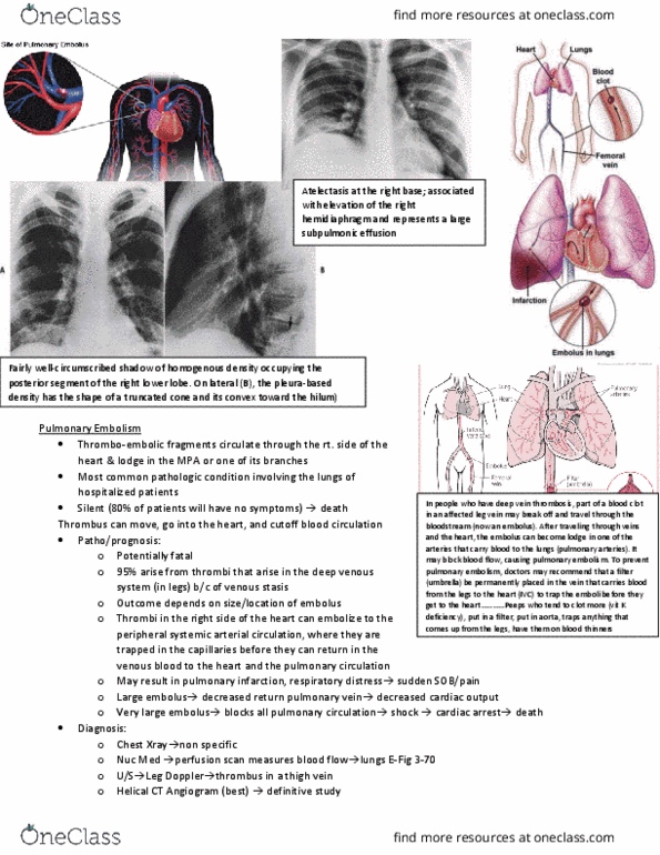 MEDRADSC 2I03 Lecture Notes - Lecture 12: Pulmonary Embolism, Pulmonary Circulation, Pulmonary Vein thumbnail