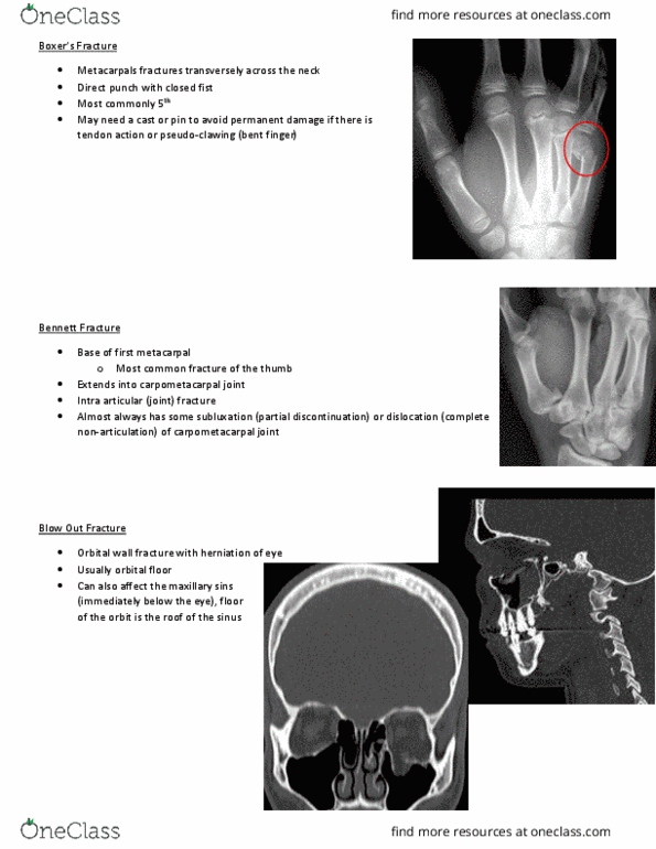 MEDRADSC 2I03 Lecture Notes - Lecture 14: Carpometacarpal Joint, Brachial Artery, Ankle thumbnail