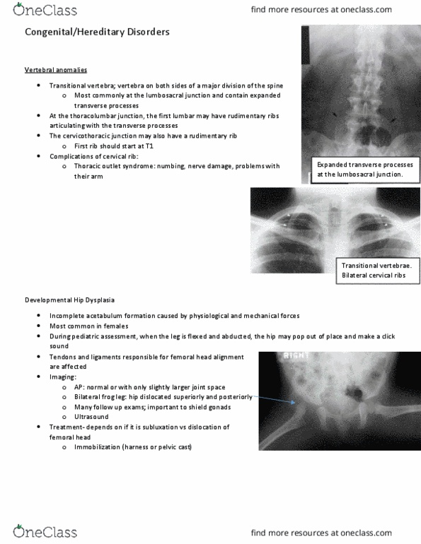 MEDRADSC 2I03 Lecture Notes - Lecture 15: Metabolic Bone Disease, Osteogenesis Imperfecta, Cervical Rib thumbnail