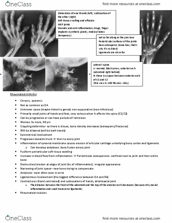 MEDRADSC 2I03 Lecture Notes - Lecture 16: Ankylosing Spondylitis, Osteoarthritis, Atlanto-Axial Joint thumbnail