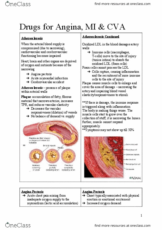 HTHSCI 2H03 Lecture Notes - Lecture 19: Angina Pectoris, Myocardial Infarction, Unstable Angina thumbnail