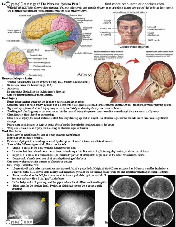 HSS 3305 Lecture Notes - Lecture 22: Intracerebral Hemorrhage, Closed Head Injury, Blunt Trauma thumbnail