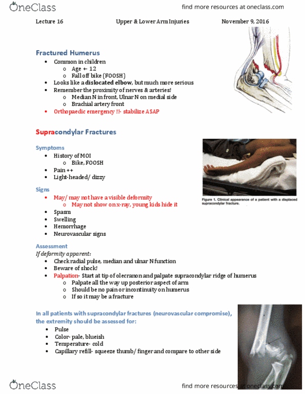 Kinesiology 3336A/B Lecture Notes - Lecture 16: Annular Ligament Of Radius, Ulnar Nerve, Brachial Artery thumbnail