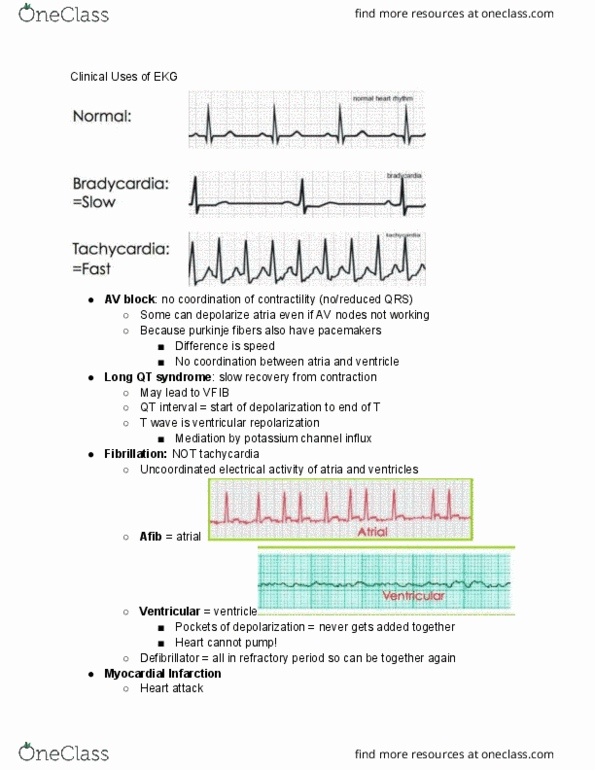 PNB 2265 Lecture Notes - Lecture 9: Pacemaker Potential, Qt Interval, Muscarinic Acetylcholine Receptor thumbnail