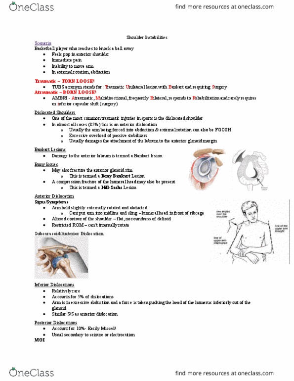 Kinesiology 3336A/B Lecture 14: 14 Shoulder Instabilities thumbnail