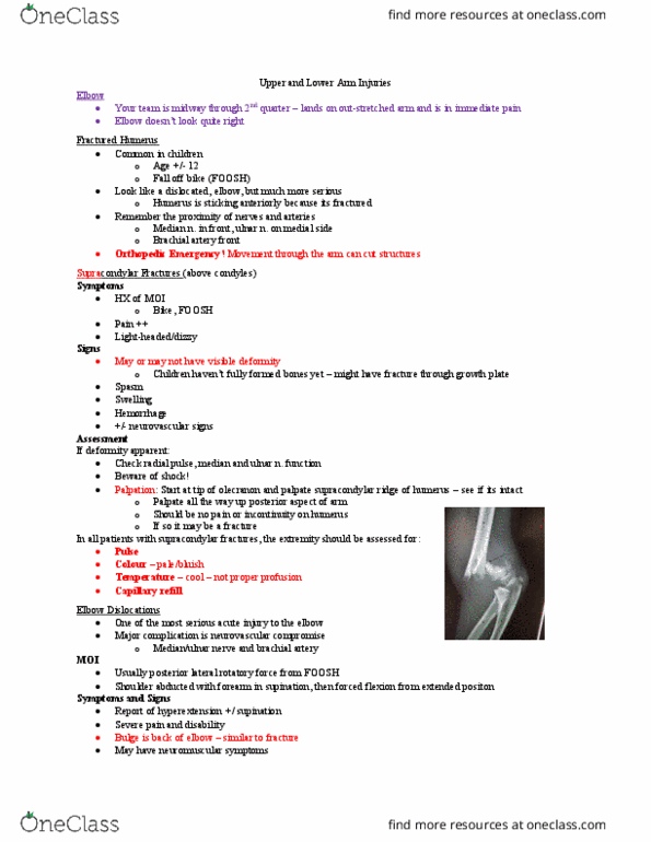 Kinesiology 3336A/B Lecture Notes - Lecture 16: Sprain, Ulna, Group C Nerve Fiber thumbnail
