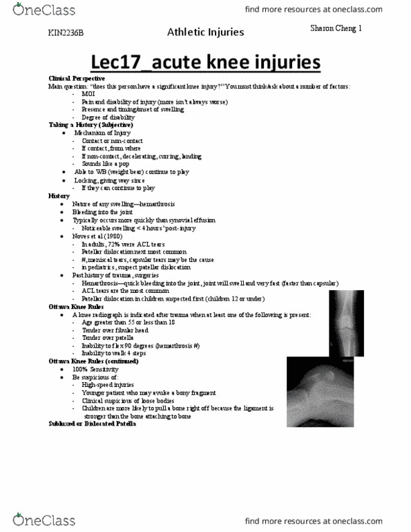 Kinesiology 2236A/B Lecture Notes - Lecture 17: Drawer Test, Sprain, Anterior Segment Of Eyeball thumbnail