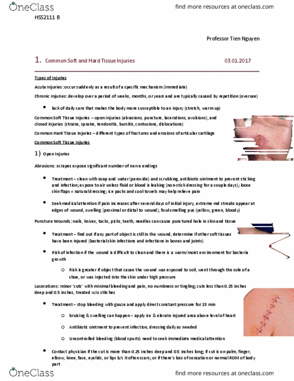 HSS 2111 Chapter Notes - Chapter 8: Sprain, Hyaline Cartilage, Exercise Intensity thumbnail