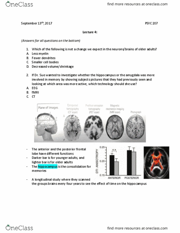 PSYC 207 Lecture Notes - Lecture 4: Reward System, Prefrontal Cortex, Occipital Lobe thumbnail