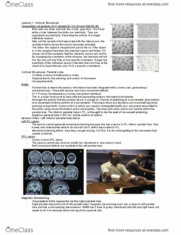 Kinesiology 3480 Lecture Notes - Lecture 7: Postcentral Gyrus, Parietal Lobe, Auditory Cortex thumbnail