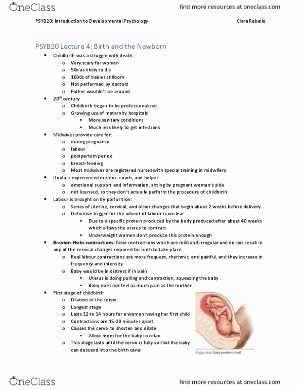 PSYB20H3 Lecture Notes - Lecture 4: Breech Birth, Neonatal Jaundice, Breast Milk thumbnail