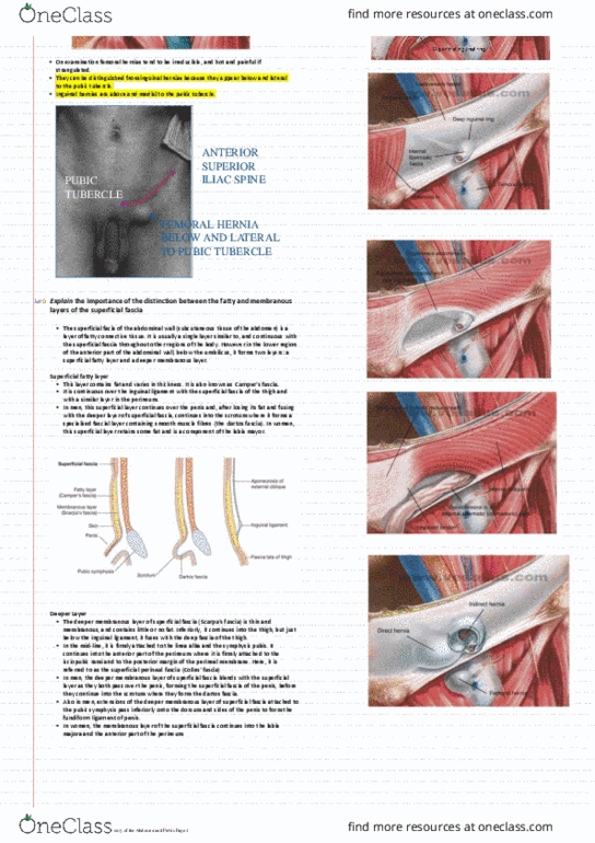 KINESIOL 1Y03 Lecture Notes - Lecture 9: Pubic Tubercle, Fascia, Inguinal Ligament thumbnail