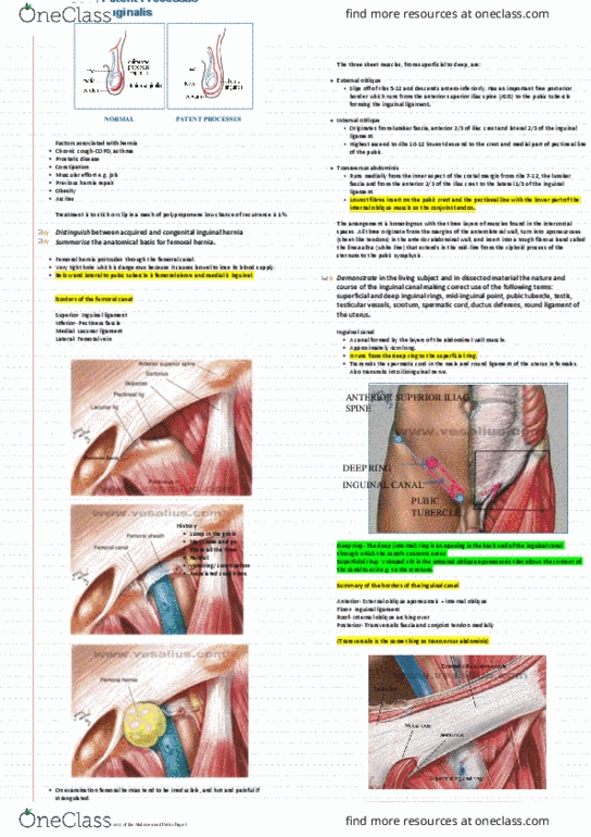 KINESIOL 1Y03 Lecture Notes - Lecture 18: Inguinal Hernia, Femoral Hernia, Transverse Fascia thumbnail