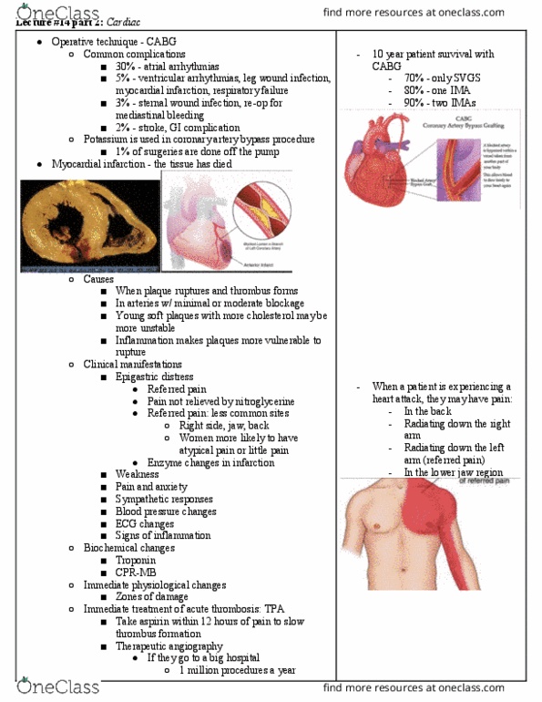 NURS 245 Lecture Notes - Lecture 15: Vulnerable Plaque, Coronary Artery Bypass Surgery, Coronary Circulation thumbnail