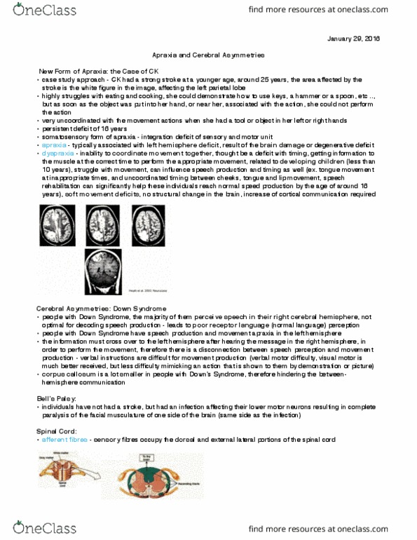 Kinesiology 1080A/B Lecture Notes - Lecture 11: Apraxia, Developmental Coordination Disorder, Parietal Lobe thumbnail