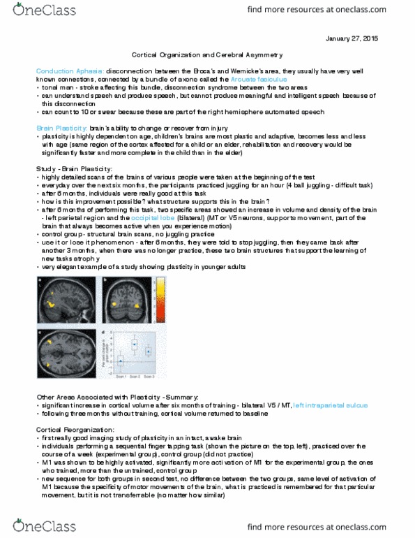Kinesiology 1080A/B Lecture Notes - Lecture 9: Intraparietal Sulcus, Occipital Lobe, Cerebral Cortex thumbnail