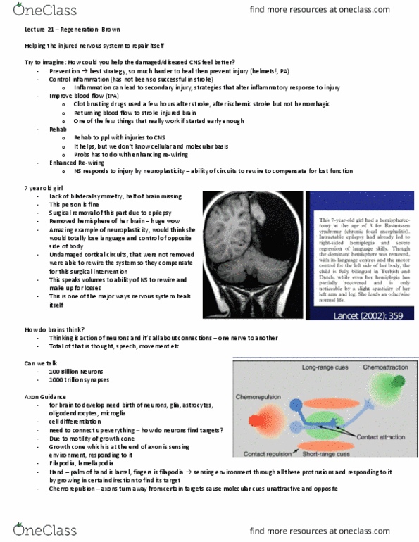 Anatomy and Cell Biology 4451F/G Lecture Notes - Lecture 21: Stroke, Growth Cone, Filopodia thumbnail