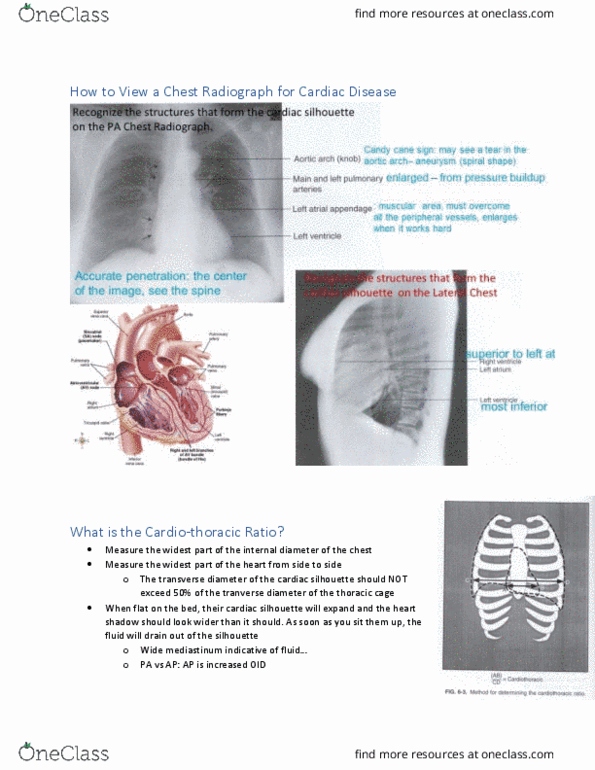 MEDRADSC 3J03 Lecture Notes - Lecture 11: Tachypnea, Digitalis, Pulmonary Circulation thumbnail