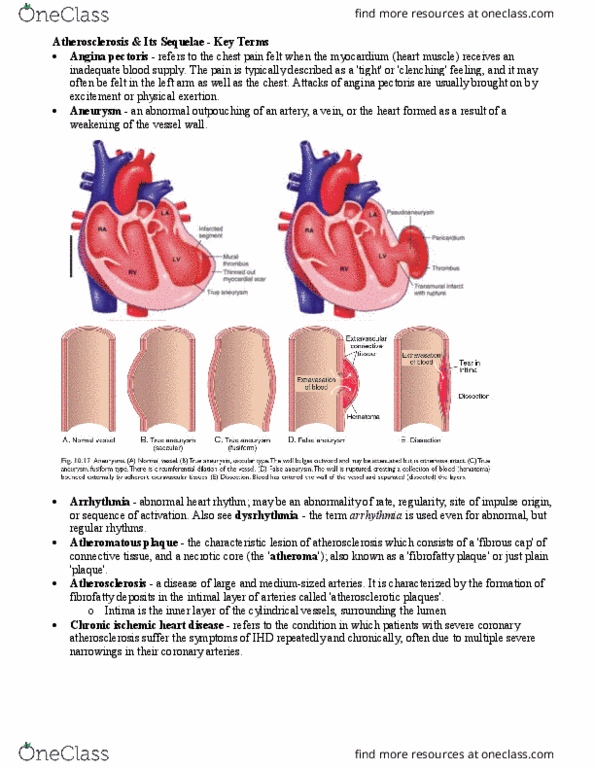 Pathology 2420A Lecture Notes - Lecture 7: Coronary Artery Disease, Intermittent Claudication, Cardiac Arrhythmia thumbnail