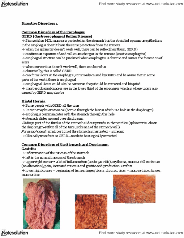HLSC 2461U Lecture Notes - Constipation, Volvulus, Inguinal Hernia thumbnail