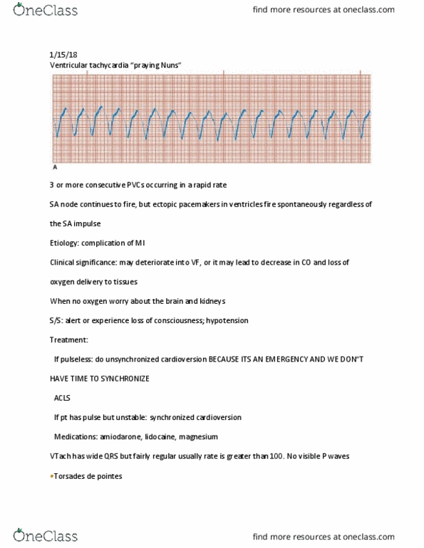 NURS 472 Lecture Notes - Lecture 3: Torsades De Pointes, Ventricular Fibrillation, Ventricular Tachycardia thumbnail