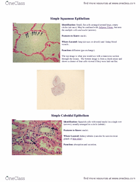 BIOB33H3 Chapter Notes -Nephron, Jejunum, Microvillus thumbnail