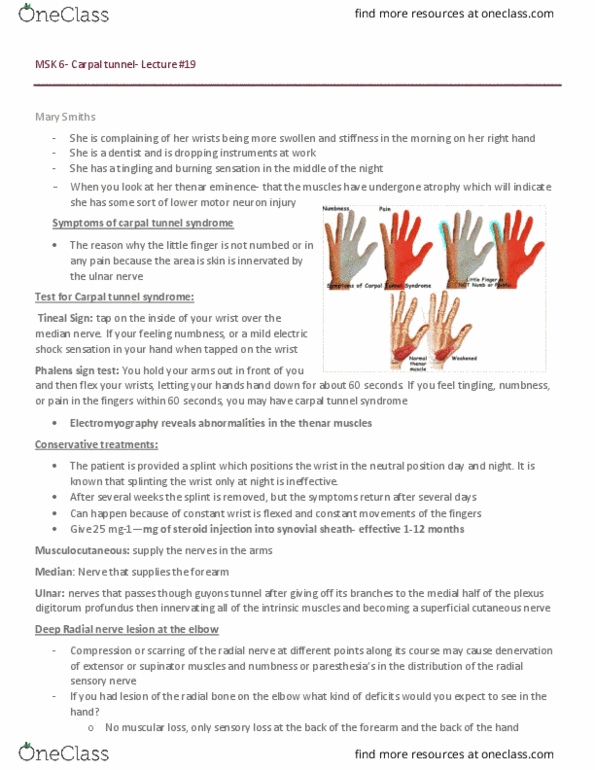 PSYCH 1X03 Lecture Notes - Lecture 14: Carpal Bones, Humerus, Carpal Tunnel Syndrome thumbnail