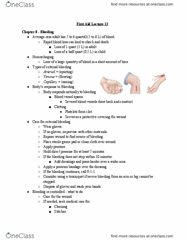 HLTH 216 Lecture Notes - Lecture 13: Internal Bleeding, Vaginal Bleeding, Tourniquet thumbnail