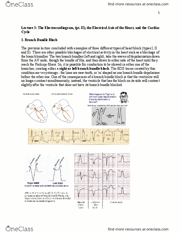 BIOC34H3 Lecture Notes - Lecture 3: Atrial Flutter, Ventricular Fibrillation, Qrs Complex thumbnail