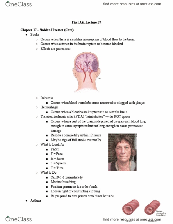 HLTH 216 Lecture Notes - Lecture 37: Chronic Lung Disease, Transient Ischemic Attack, Blood Vessel thumbnail