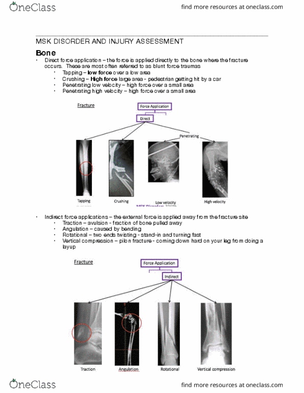 Rehabilitation Sciences 3360A/B Lecture Notes - Lecture 3: Pilon Fracture, Radiodensity, Polytrauma thumbnail