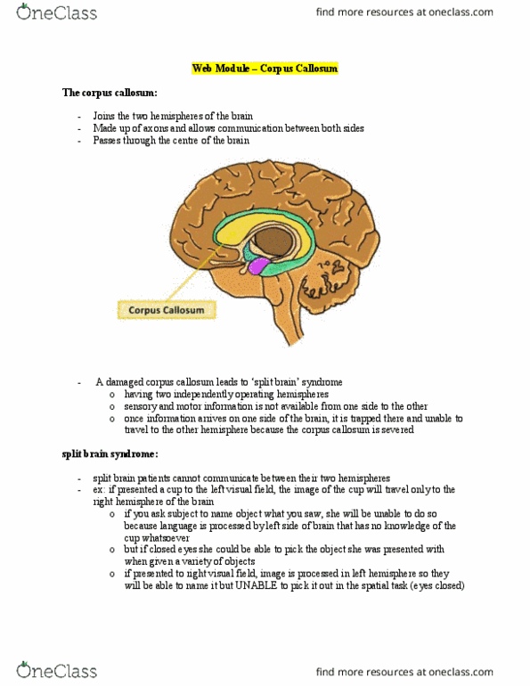 PSYCH 1XX3 Chapter Notes - Chapter Neuroscience: Lateralization Of Brain Function thumbnail
