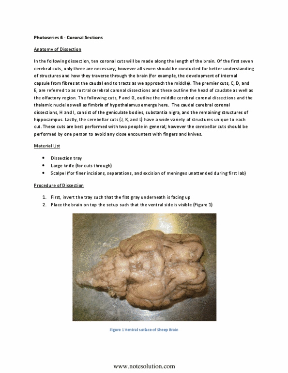 NROB60H3 Chapter Notes -Trapezoid Body, Abducens Nerve, Mammillary Body thumbnail