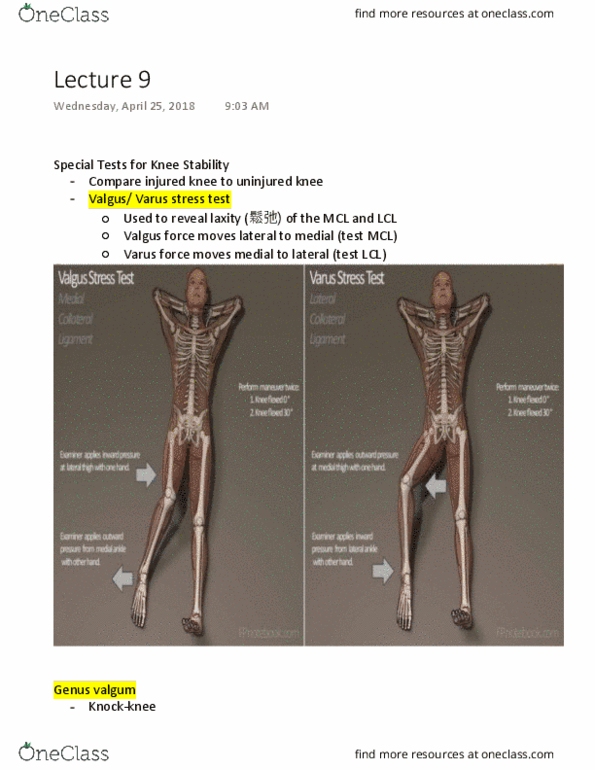 ESS 150 Lecture Notes - Lecture 9: Fibular Collateral Ligament, Medial Meniscus, Sprain thumbnail