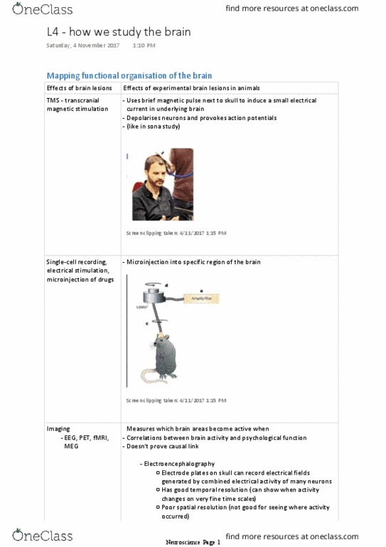 PSYC1002 Lecture Notes - Lecture 9: Electroencephalography, Magnetoencephalography, Electromagnetic Interference thumbnail