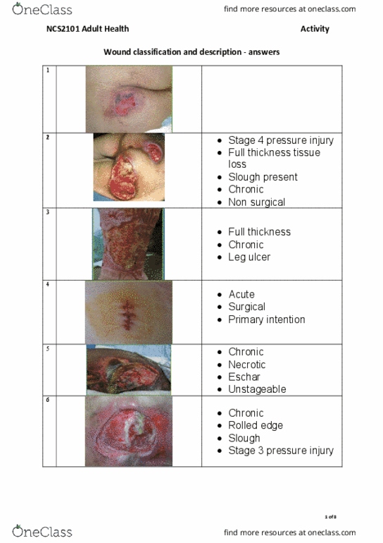 surgical site wound classification