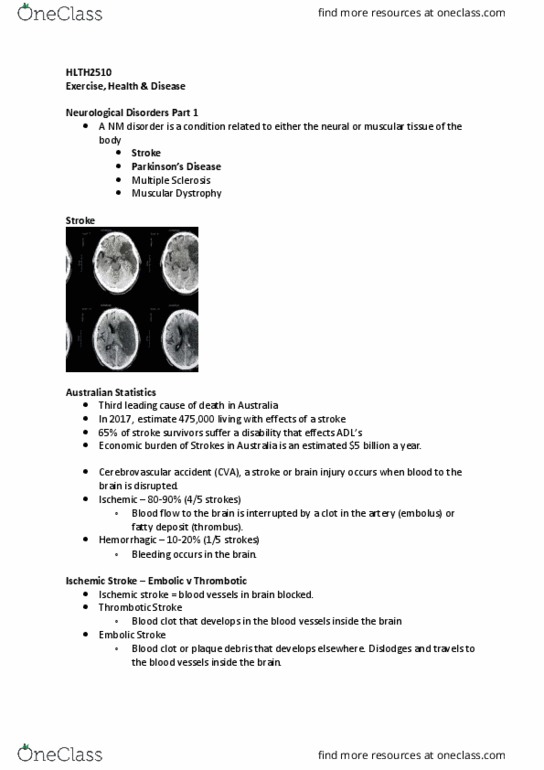 HLTH2510 Lecture Notes - Lecture 9: Motor Coordination, Dyskinesia, Substantia Nigra thumbnail