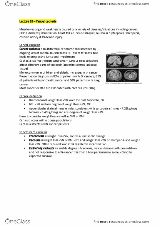 PHYS30005 Lecture Notes - Lecture 18: Myocyte, Pancreatic Cancer, Chronic Obstructive Pulmonary Disease thumbnail