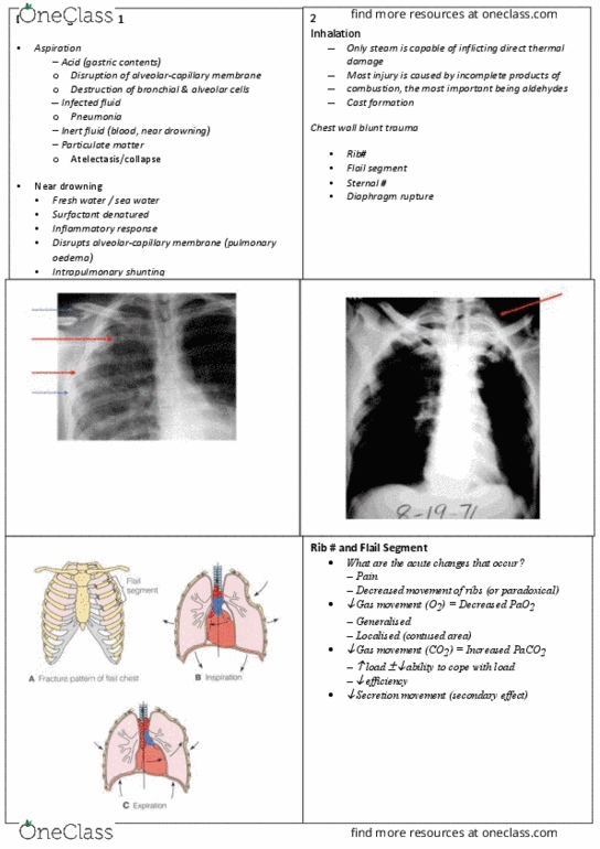 PHTY300 Lecture Notes - Lecture 6: Particulates, 48Hours, Subcutaneous Emphysema thumbnail