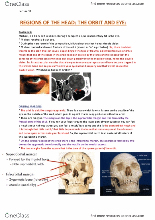 ANAT30008 Lecture Notes - Lecture 32: Uvea, Choroid, Fibrocartilage thumbnail