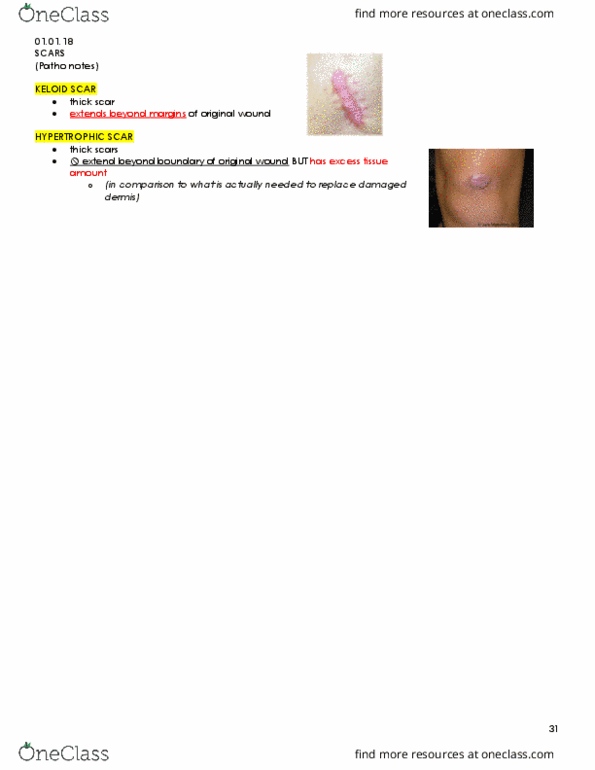 KINESIOL 1Y03 Lecture Notes - Lecture 11: Dermis, Orthostatic Hypotension, Sepsis thumbnail