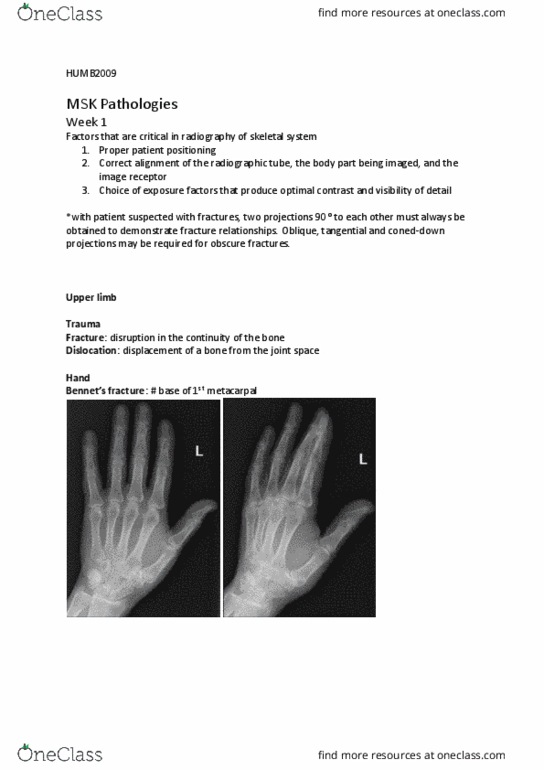 HUMB2009 Lecture Notes - Lecture 1: Upper Limb, Radiography, Metacarpal Bones thumbnail