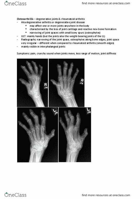 HUMB2009 Lecture Notes - Lecture 1: Rheumatoid Arthritis, Osteophyte, Osteoporosis thumbnail