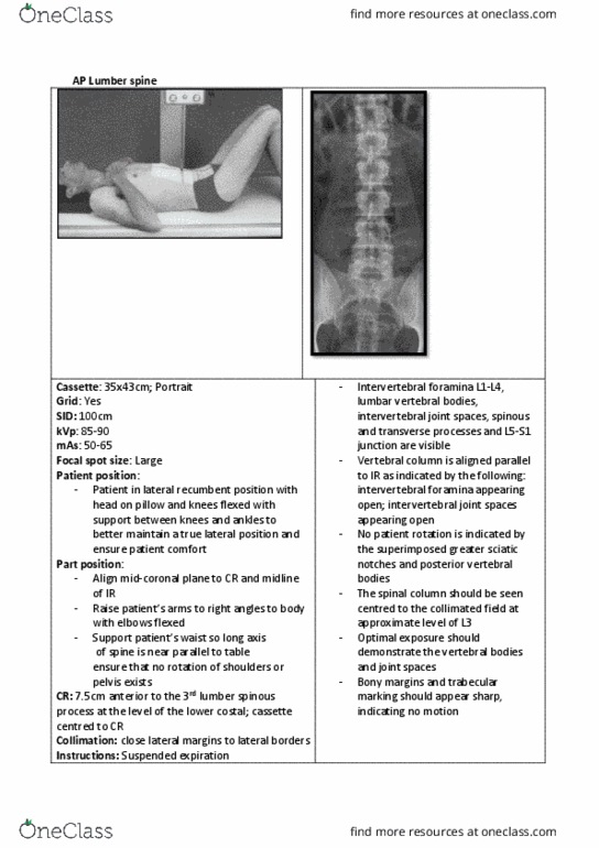 MIRA2004 Lecture 6: T&L spine 2 thumbnail