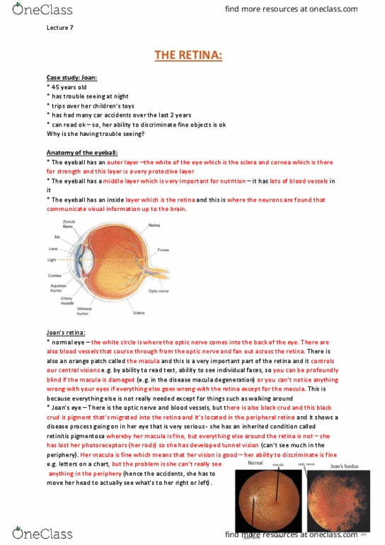 NEUR30003 Lecture Notes - Lecture 7: Bionics, Amacrine Cell, Shining Light thumbnail