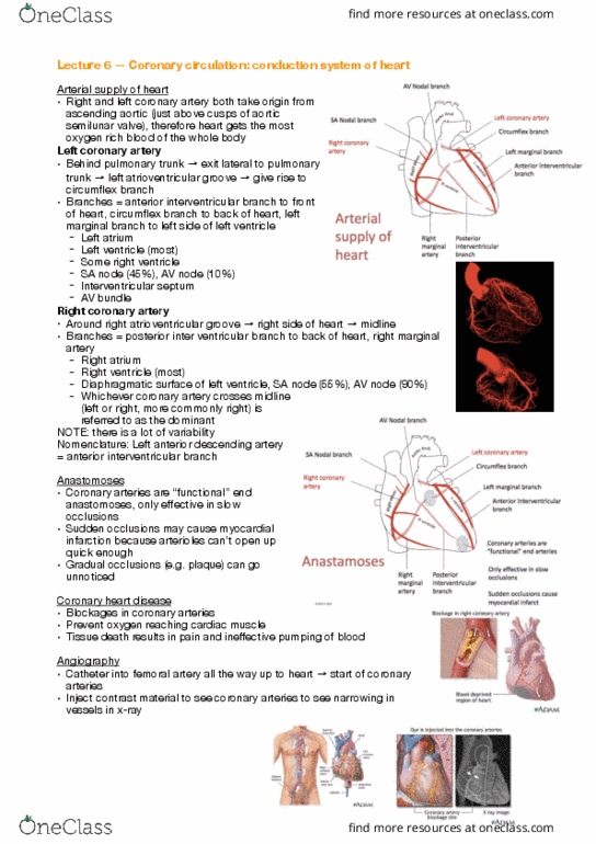 ANAT30008 Lecture Notes - Lecture 6: Coronary Sinus, Coronary Artery Bypass Surgery, Angioplasty thumbnail