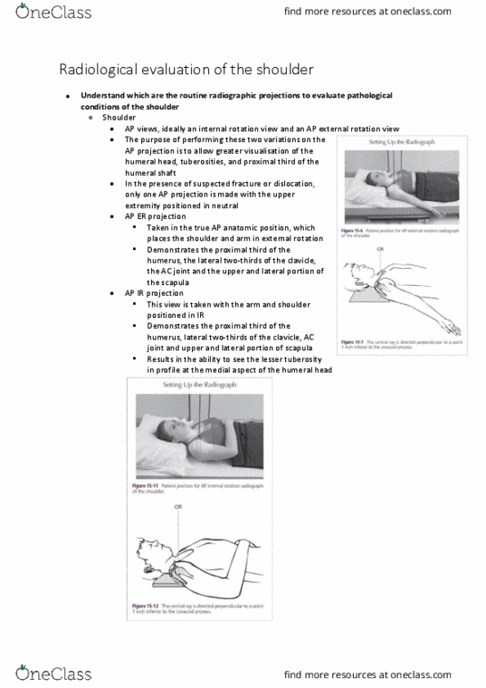 PHTY207 Lecture Notes - Lecture 10: Bankart Lesion, Joint Stability, Metaplasia thumbnail